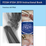 (eBook PDF)Distal Radius Fractures and Carpal Instabilities: FESSH IFSSH 2019 Instructional Book 1st Edition by Francisco del Pinal  Thieme; 1st Edition (June 24, 2019)
