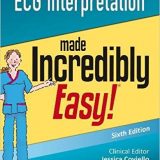 (eBook PDF)ECG Interpretation Made Incredibly Easy! 6th Edition by Lippincott Williams & Wilkins