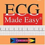 (eBook PDF)ECG Made Easy 6th Edition by Atul Luthra