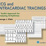 (eBook PDF)ECG and Intracardiac Tracings: A Toolkit Approach for Analyzing Arrhythmias