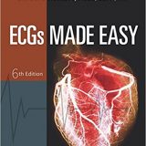 (eBook PDF)ECGs Made Easy, 6th Edition by Barbara J Aehlert RN BSPA