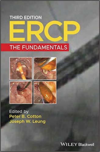 (eBook PDF)ERCP The Fundamentals 3rd Edition by Peter B. Cotton , Joseph W. Leung