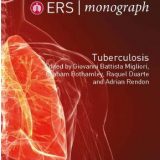 (eBook PDF)ERS Monograph 82 Tuberculosis
