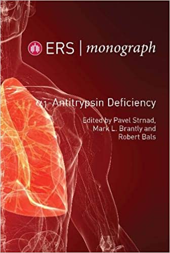 (eBook PDF)ERS Monograph 85 Alpha-1-Antitrypsin Defieciency by Pavel Strnad , Mark L. Brantly , Robert Bals