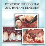 (eBook PDF)Economic Periodontal and Implant Dentistry by Rainer Buchmann