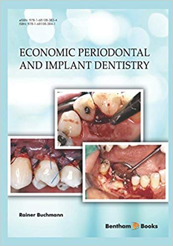 (eBook PDF)Economic Periodontal and Implant Dentistry by Rainer Buchmann