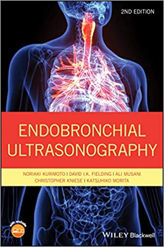 (eBook PDF)Endobronchial Ultrasonography 2nd Edition  by Noriaki Kurimoto , David K. Fielding , Ali Musani , Christopher Kniese , Katsuhiko Morita