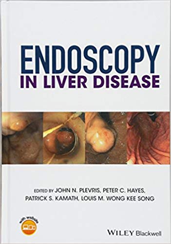 (eBook PDF)Endoscopy in Liver Disease by John N. Plevris , Peter C. Hayes , Patrick S. Kamath , Louis-Michel Wong Kee Song
