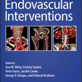 (eBook PDF)Endovascular Interventions by  Jose M. Wiley , Cristina Sanina , Peter Faries