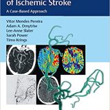 (eBook PDF)Endovascular Management of Ischemic Stroke: A Case-Based Approach 1st Edition by Vitor Mendes Pereira , Adam A. Dmytriw