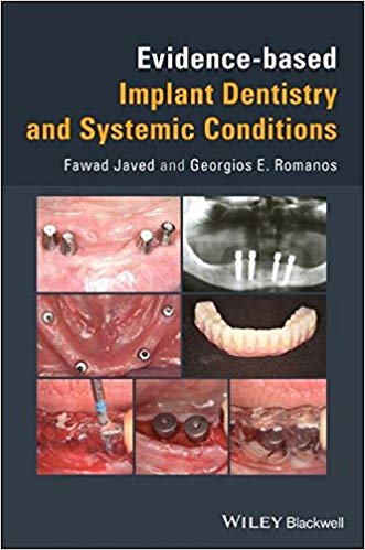 (eBook PDF)Evidence-based Implant Dentistry and Systemic Conditions by Javed , Georgios Romanos