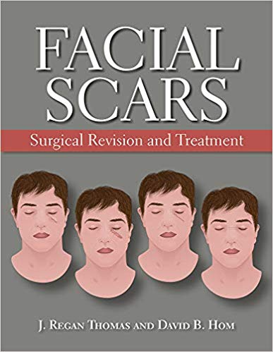 (eBook PDF)Facial Scars: Surgical Revision and Treatment by J. Regan Thomas MD , David B. Hom MD