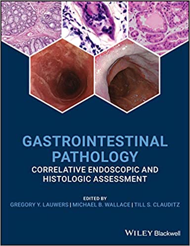 (eBook PDF)Gastrointestinal Pathology Correlative Endoscopic and Histologic Assessment by Gregory Y. Lauwers , Michael B. Wallace , Till S. Clauditz (Co-editor)