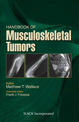 (eBook PDF)Handbook of Musculoskeletal Tumors by Matthew T Wallace MD MBA , Frank J Frassica MD