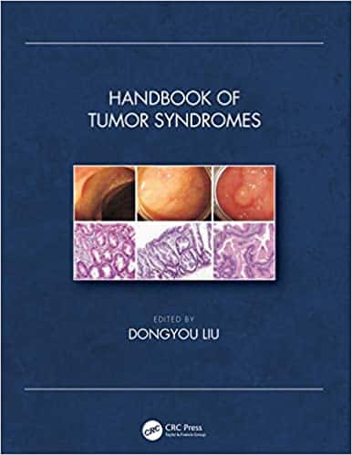 (eBook PDF)Handbook of Tumor Syndromes