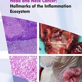 (eBook PDF)Head and Neck Cancer Hallmarks of the Inflammation Ecosystem by Norhafiza Mat Lazim