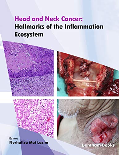 (eBook PDF)Head and Neck Cancer Hallmarks of the Inflammation Ecosystem by Norhafiza Mat Lazim