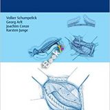 (eBook PDF)Hernia Surgery by Volker Schumpelick , Georg Arlt , Joachim Conze