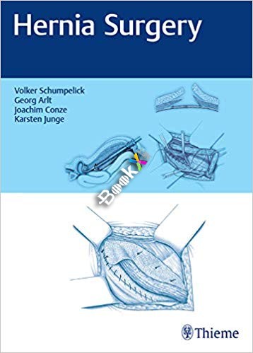 (eBook PDF)Hernia Surgery by Volker Schumpelick , Georg Arlt , Joachim Conze