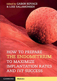 (eBook PDF)How to Prepare the Endometrium to Maximize Implantation Rates and IVF Success by Gabor Kovacs, Lois Salamonsen