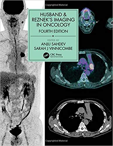 (eBook PDF)Husband and Rezneks Imaging in Oncology 4th Edition by Anju Sahdev , Sarah J. Vinnicombe