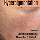 (eBook PDF)Hyperpigmentation by Dimitris Rigopoulos , Alexander C. Katoulis