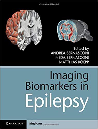 (eBook PDF)Imaging Biomarkers in Epilepsy by Andrea Bernasconi , Neda Bernasconi , Matthias Koepp