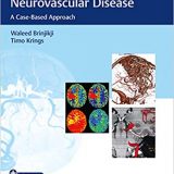 (eBook PDF)Imaging in Neurovascular Disease: A Case-Based Approach by Waleed Brinjikji , Timo Krings