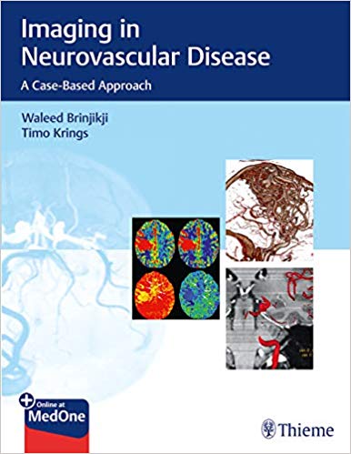 (eBook PDF)Imaging in Neurovascular Disease: A Case-Based Approach by Waleed Brinjikji , Timo Krings
