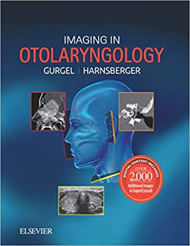 (eBook PDF)Imaging in Otolaryngology by Richard K. Gurgel , H. Ric Harnsberger