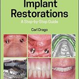 (eBook PDF)Implant Restorations A Step-by-Step Guide 4th Edition by Carl Drago