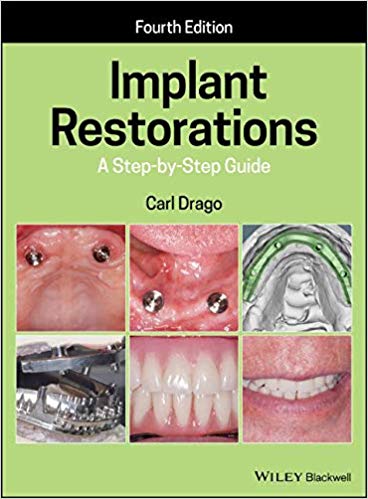 (eBook PDF)Implant Restorations A Step-by-Step Guide 4th Edition by Carl Drago