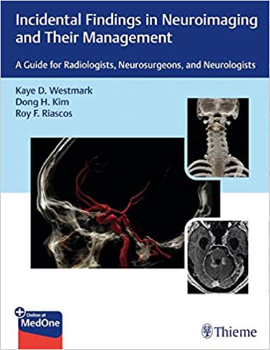(eBook PDF)Incidental Findings in Neuroimaging and Their Management by Kaye Westmark , Dong Kim , Roy Riascos
