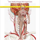 (eBook PDF)Injury Illustrated How Medical Images Win Legal Cases by R. Annie Gough