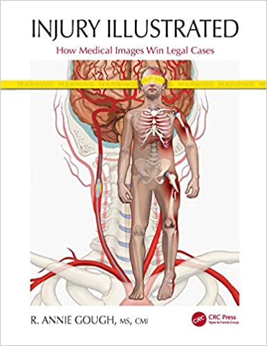 (eBook PDF)Injury Illustrated How Medical Images Win Legal Cases by R. Annie Gough