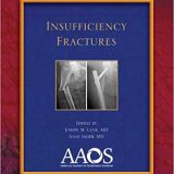 (eBook PDF)Insufficiency Fractures (Monograph Series AAOS) by American Academy of Orthopaedic Surgeons , Joseph M. Lane MD , Anas Saleh MD (Illustrator)
