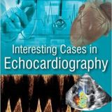 (eBook PDF)Interesting Cases in Echocardiography by Navin C. Nanda