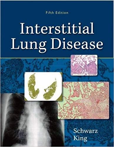 (eBook PDF)Interstitial Lung Disease 5th Edition  by Marvin I. Schwartz , Talmadge E. King