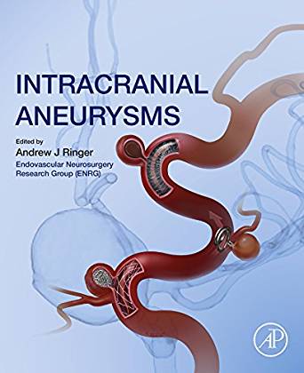 (eBook PDF)Intracranial Aneurysms by Andrew J. Ringer