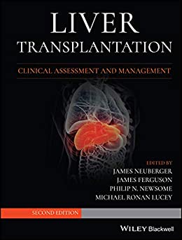 (eBook PDF)Liver Transplantation: Clinical Assessment and Management by James Neuberger , James Ferguson , Philip N. Newsome , Michael R. Lucey