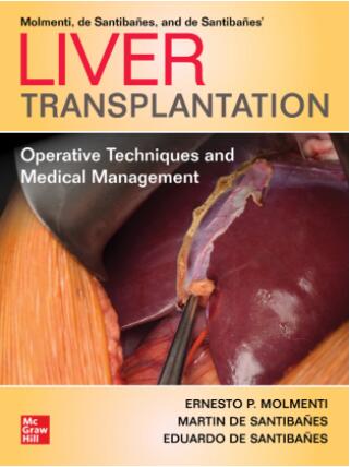 (eBook PDF)Liver Transplantation Operative Techniques and Medical Management by Ernesto P. Molmenti, Martin de Santibañes, Eduardo de Santibañes
