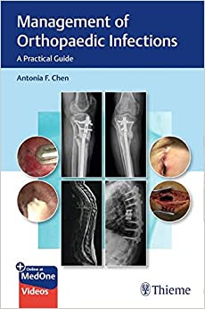 (eBook PDF)Management of Orthopaedic Infections PDF+EPUB by Antonia Chen