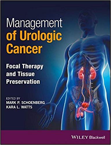 (eBook PDF)Management of Urologic Cancer by Mark P. Schoenberg , Kara L. Watts