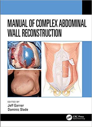 (eBook PDF)Manual of Complex Abdominal Wall Reconstruction by Jeff Garner , Dominic Slade
