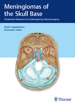 (eBook PDF)Meningiomas of the Skull Base: Treatment Nuances in Contemporary Neurosurgery 1st Edition