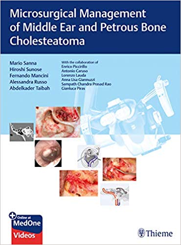 (eBook PDF)Microsurgical Management of Middle Ear and Petrous Bone Cholesteatoma (PDF+VIDEOS) by Mario Sanna , Hiroshi Sunose , Fernando Mancini , Alessandra Russo , Abdelkader Taibah