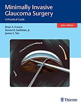(eBook PDF)Minimally Invasive Glaucoma Surgery: A Practical Guide + Videos by Brian Francis , Steven Sarkisian , James C. Tan