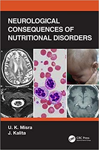 (eBook PDF)Neurological Consequences of Nutritional Disorders 1st Edition by U. K. Misra , J. Kalita
