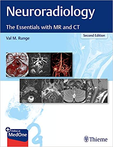 (eBook PDF)Neuroradiology The Essentials with MR and CT, 2nd Edition by Val M. Runge  Thieme; 2nd Edition (September 1, 2020)