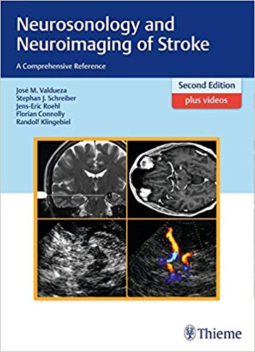 (eBook PDF)Neurosonology and Neuroimaging of Stroke, 2nd Edition + 1st Edition + Videos by José Manuel Valdueza , Stephan Schreiber , Jens-Eric Röhl , Florian Connolly , Randolf Klingebiel